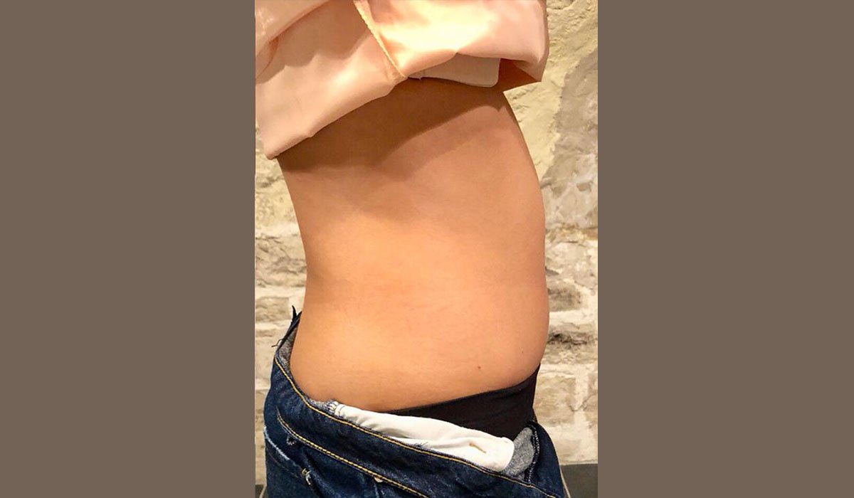 Lipocavitation – Cocoonin' Paris Lipocavitation – Cocoonin' Paris